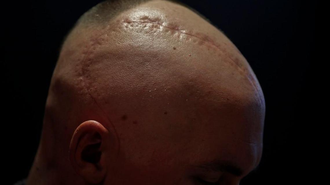 ‘Feasting on God’s word’: Texas minister battles brain cancer with gratitude and grace