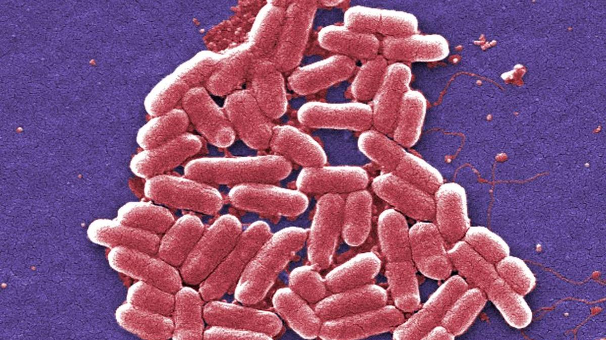 This colorized scanning electron micrograph image made available by the Centers for Disease Control and Prevention shows E. coli bacteria. E. coli sickened at least 500 visitors at a zipline attraction in Gatlinburg, Tennessee, state health officials confirmed.
